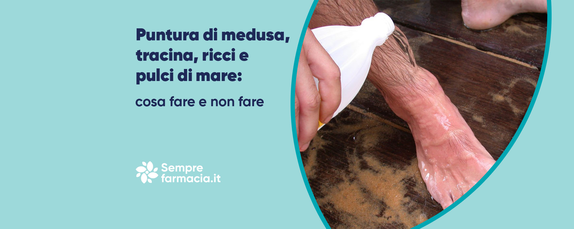 Puntura di medusa, tracina, ricci, pulci di mare: cosa fare e non fare